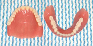 義歯治療-2